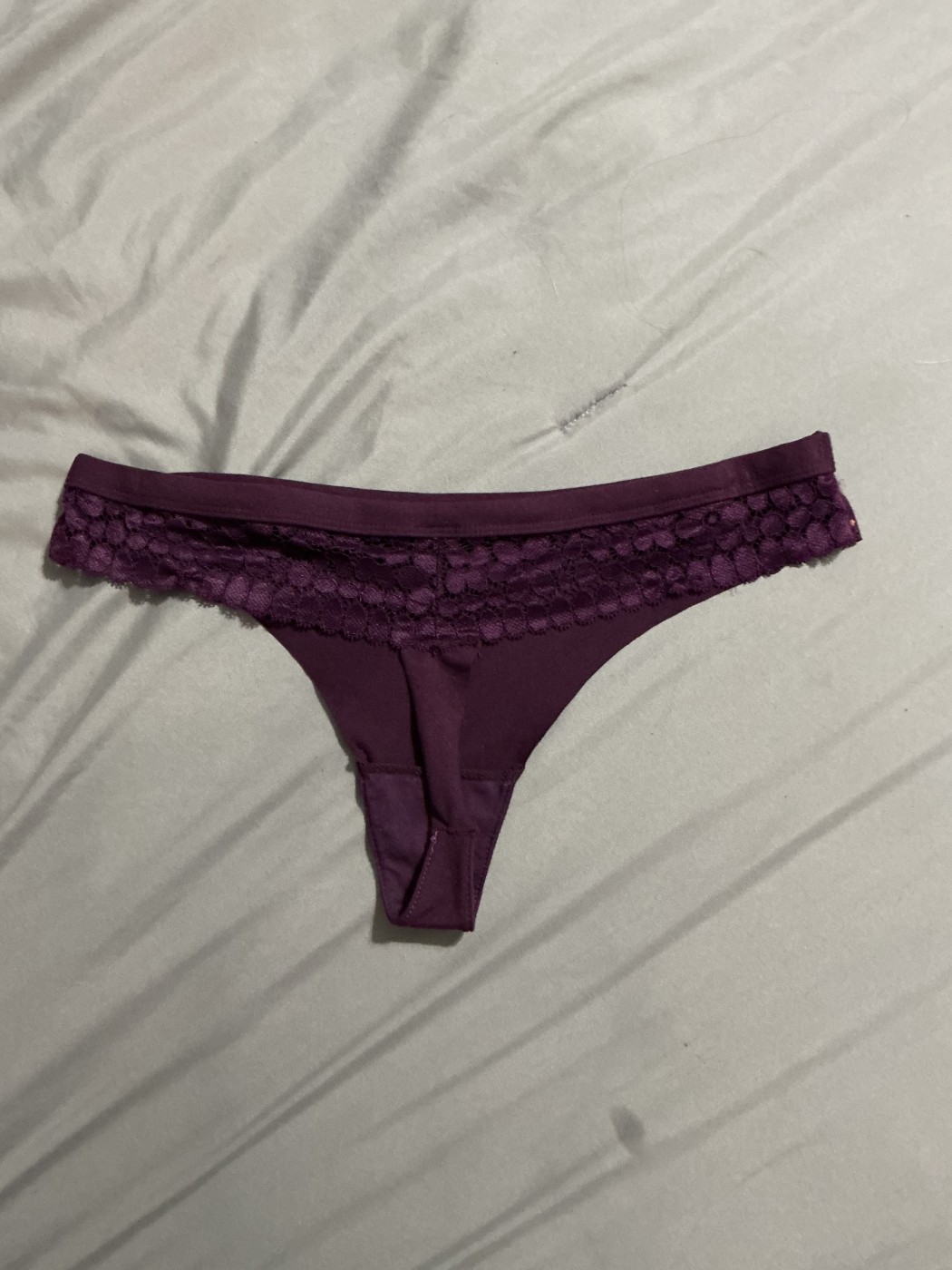Tanguitas con secretes olorosos – foto 3 de 3