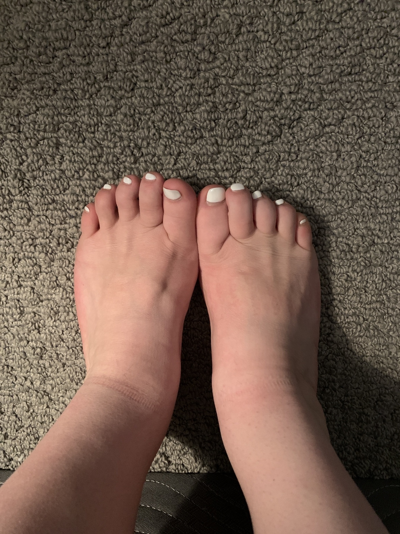 Feet pics white toes