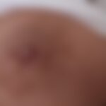 KRISS_VICI