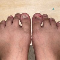 Custom Ugly Feet