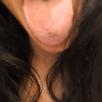 Labbra carnose, pronte ad accogl…